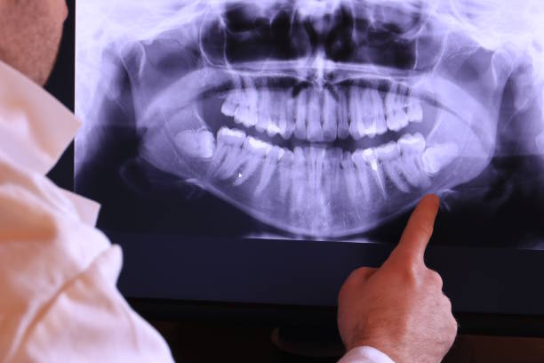 Best Root Canal Emergency Dentist  in White Pigeon, MI