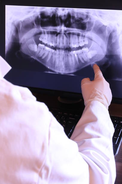 Tooth Infection Emergency Dentist in MI