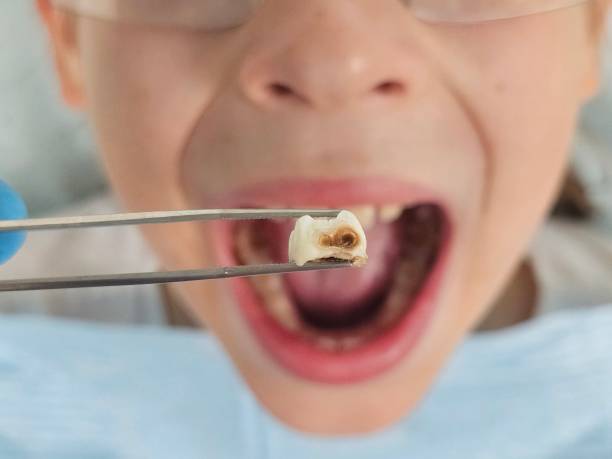 Best Dental Emergency Near Me  in White Pigeon, MI